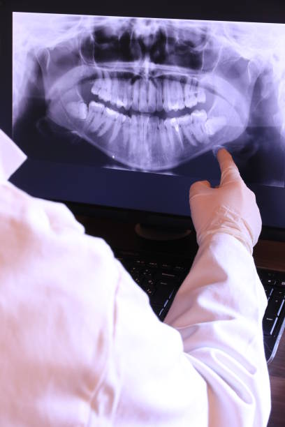 Best Emergency Dental Extractions in Meeker, OK
