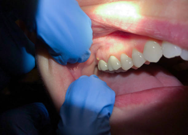 Best Emergency Dental Services for Seniors in Meeker, OK