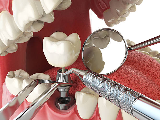Best Emergency Dentist for Knocked-Out Tooth in Meeker, OK